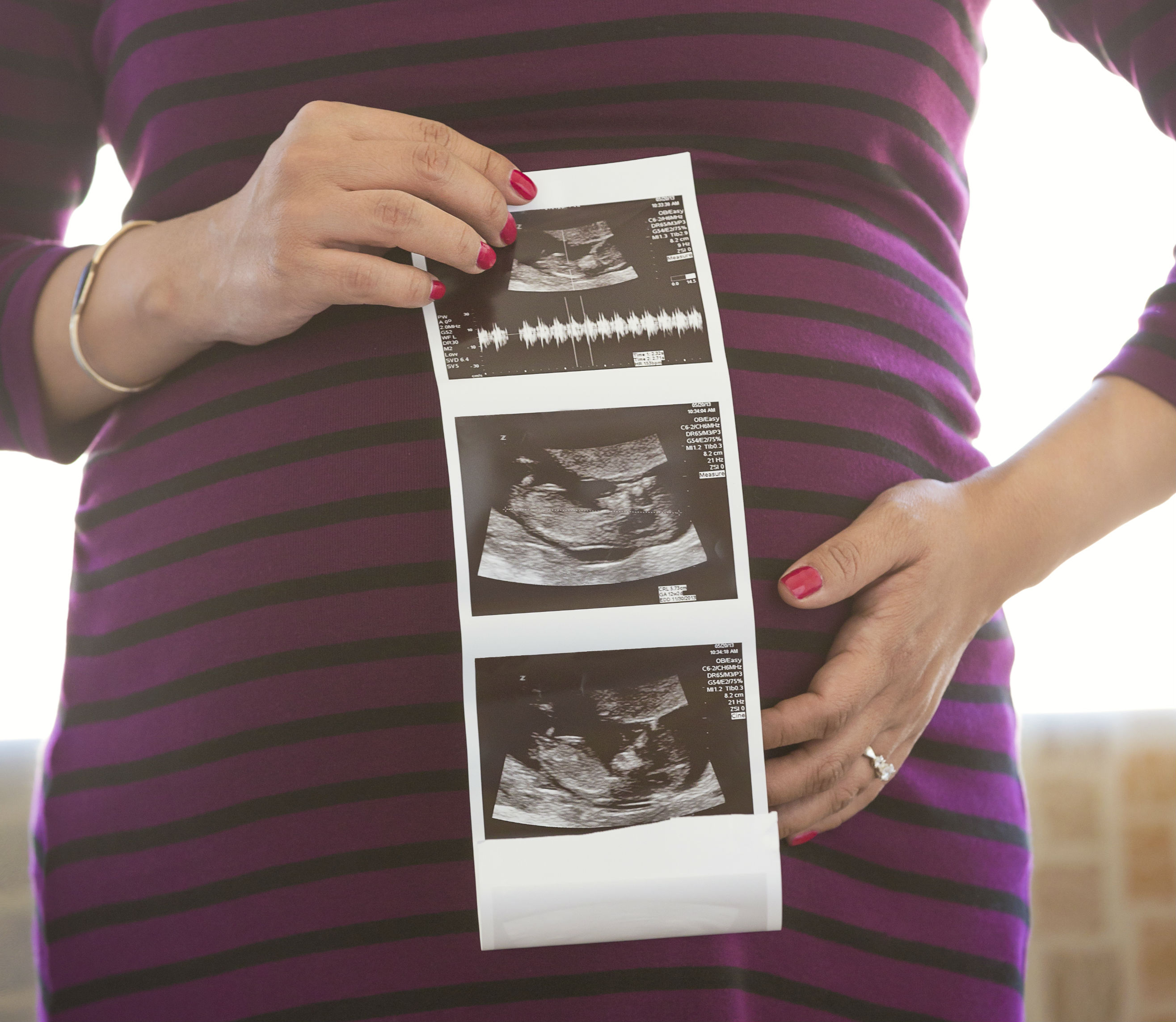 Use of CT scans during pregnancy increased in U.S. and Canada over 2 decades
