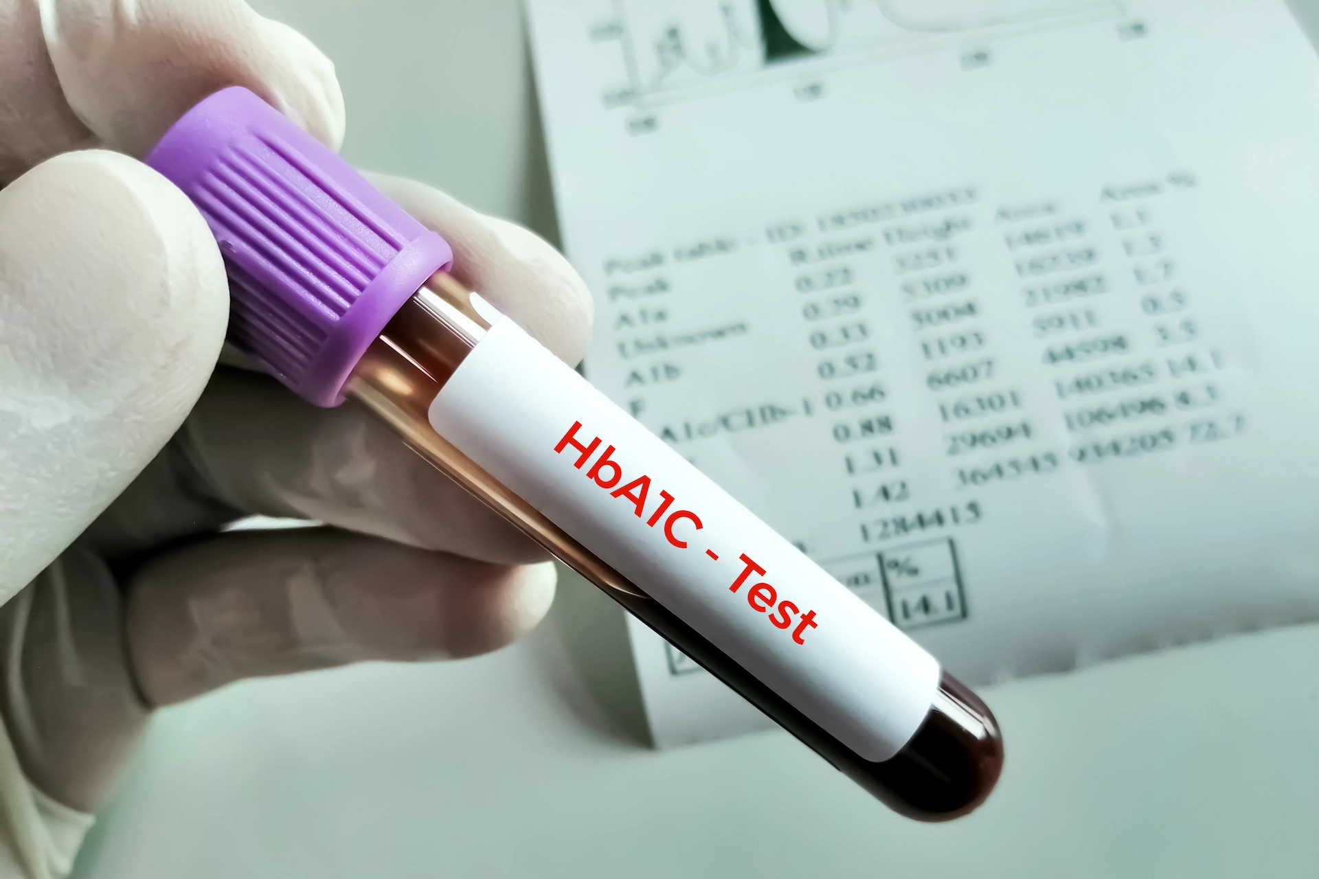 Blood test often incorrectly estimates blood sugar control in Black adults