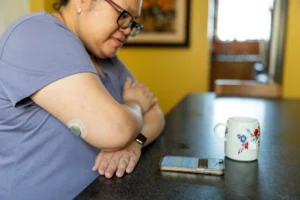 Continuous glucose monitors sustain lower blood sugar and reduce risk for chronic kidney disease in people with type 2 diabetes